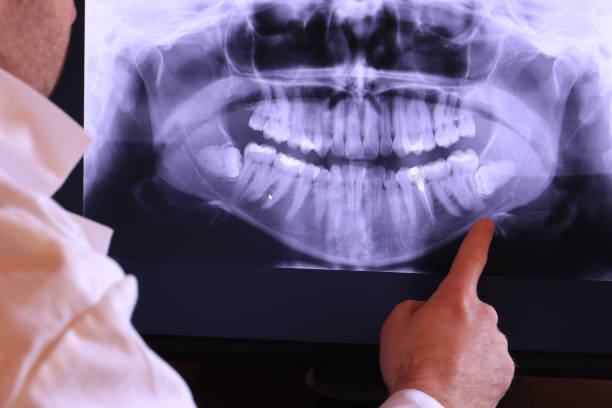 Best Emergency Tooth Extraction in Southside Place, TX